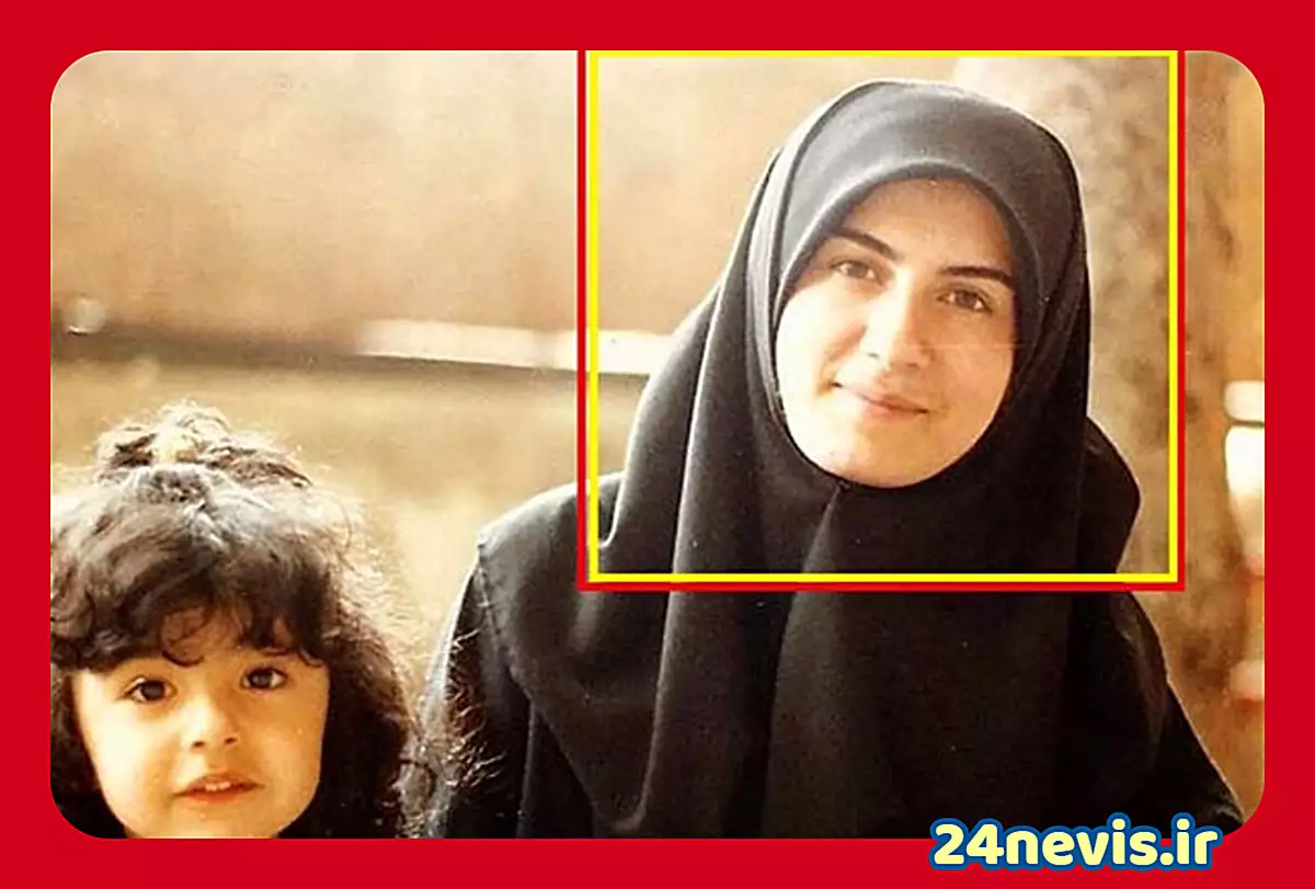 عکس گیتی خامنه قبل از عمل